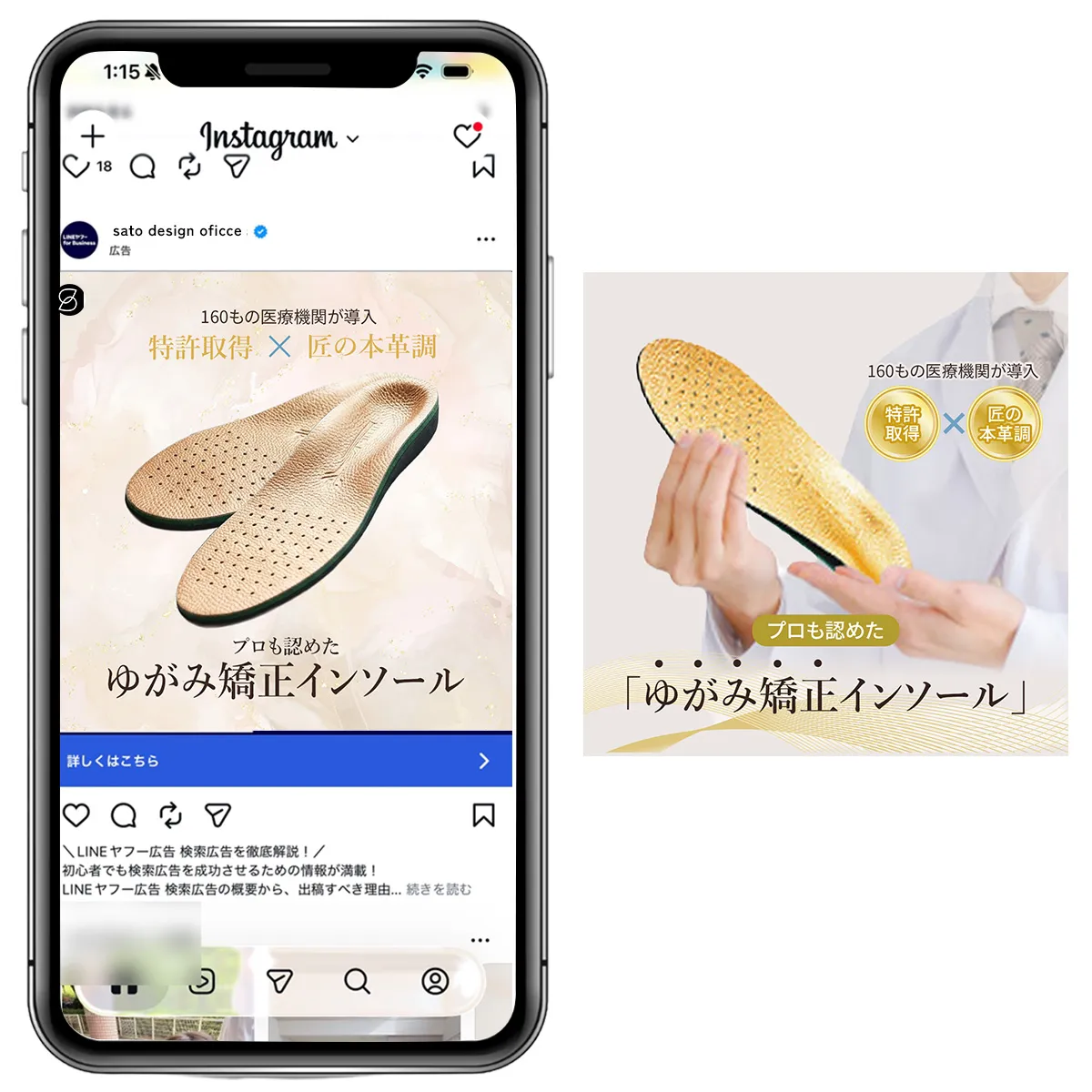 インソールw